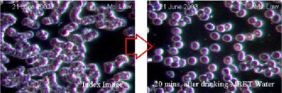 live blood cells analysis