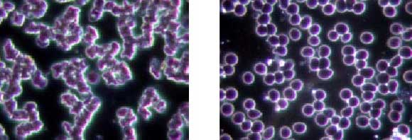 live blood cells analysis