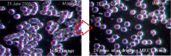 live blood cells analysis